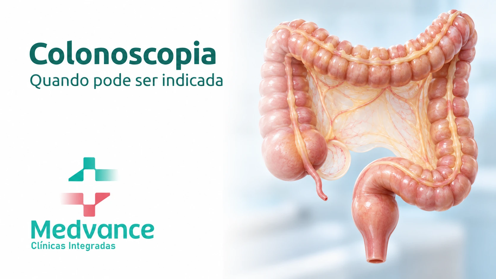 Capa Medvance sobre indicação de colonoscopia, com ilustração educativa do intestino grosso.