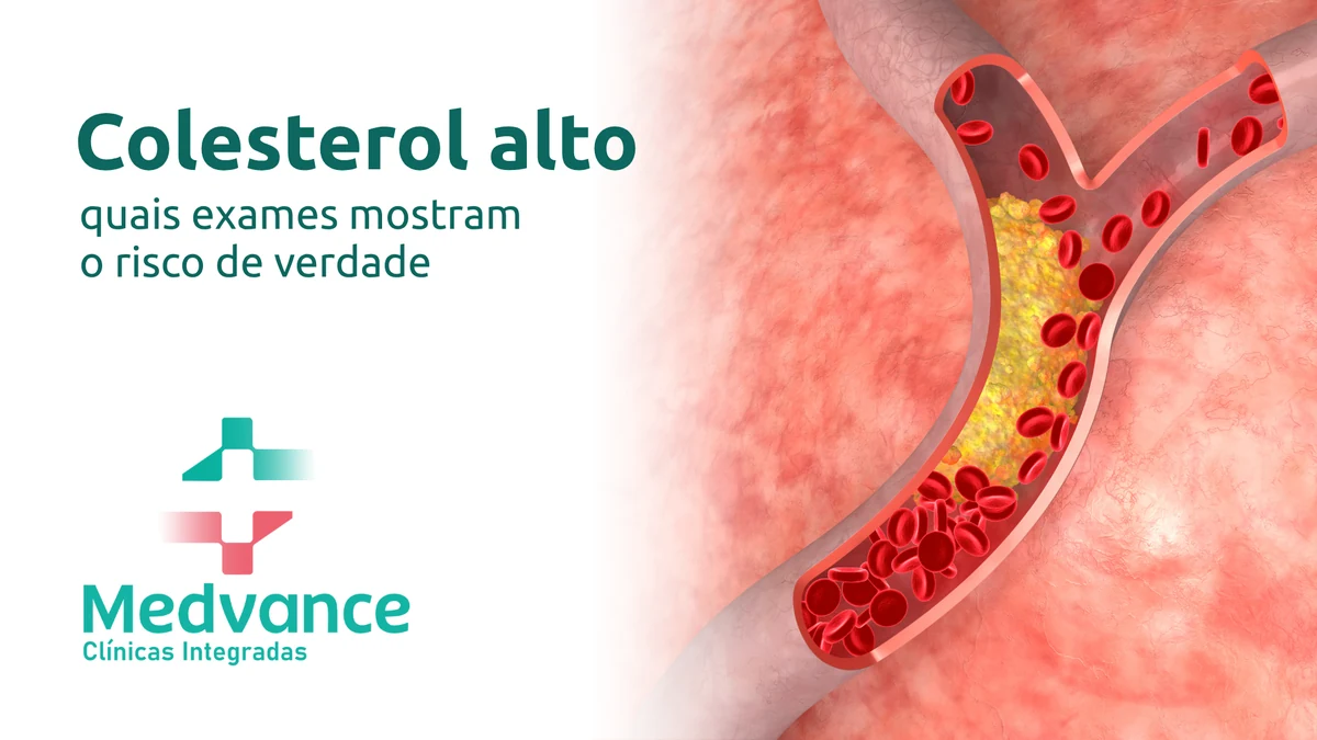 Capa Medvance sobre colesterol alto, com ilustração de artéria com acúmulo de gordura.