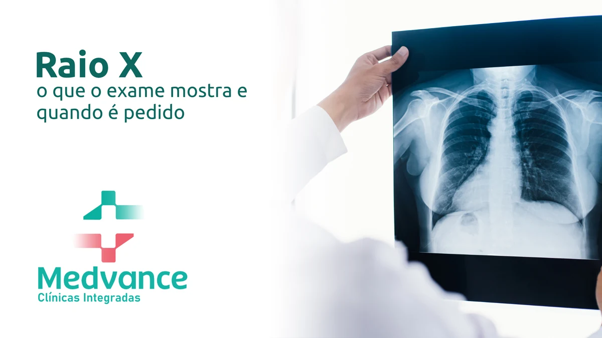 Capa Medvance sobre raio X, com profissional segurando uma radiografia de tórax.